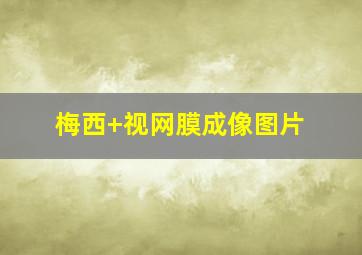 梅西 视网膜成像图片